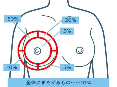 乳房超音波検査